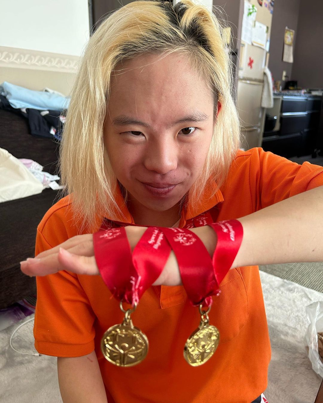 右手の指がないダウン症スイマー　「水泳の次はモデルに」重複障害をもつ青年の努力