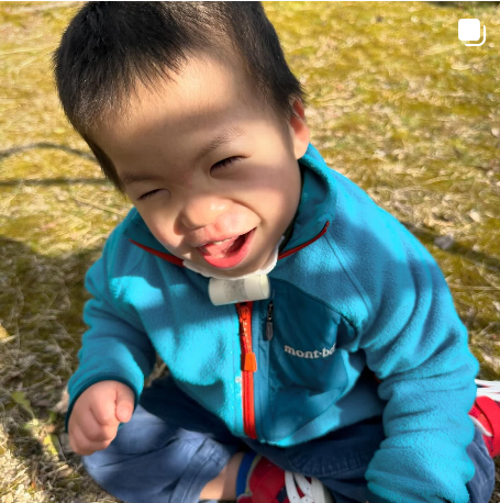 「中絶も進められた」難病を抱える5歳の息子を支える母親　「生きたいだけ、生きたらいい」その思いに迫る