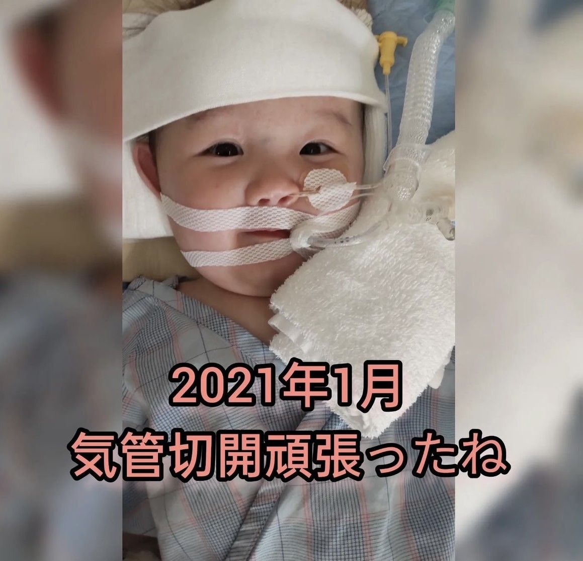 気管切開後…ん提供)