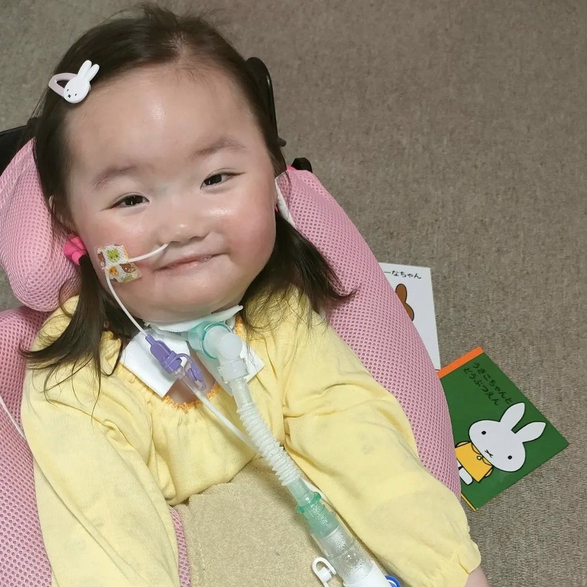 「娘の体重が増えない」生後2ヶ月、両親が感じた不安　数ヶ月後…「娘は小学生になれないかも」　世界で”60症例”の難病と向き合う家族の思い